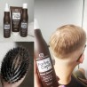 Full Anti-Hair Loss Treatment Routine with Vitamins by FORTE CAPIL