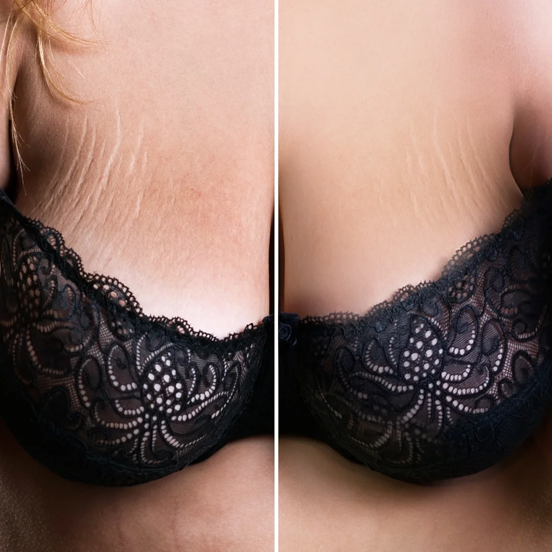 Breast enlargement and restoration cream by No Bra, buy online
