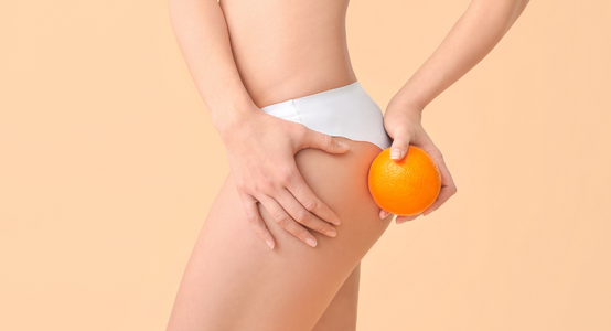 The Fight Against Cellulite: How to Get Rid of It